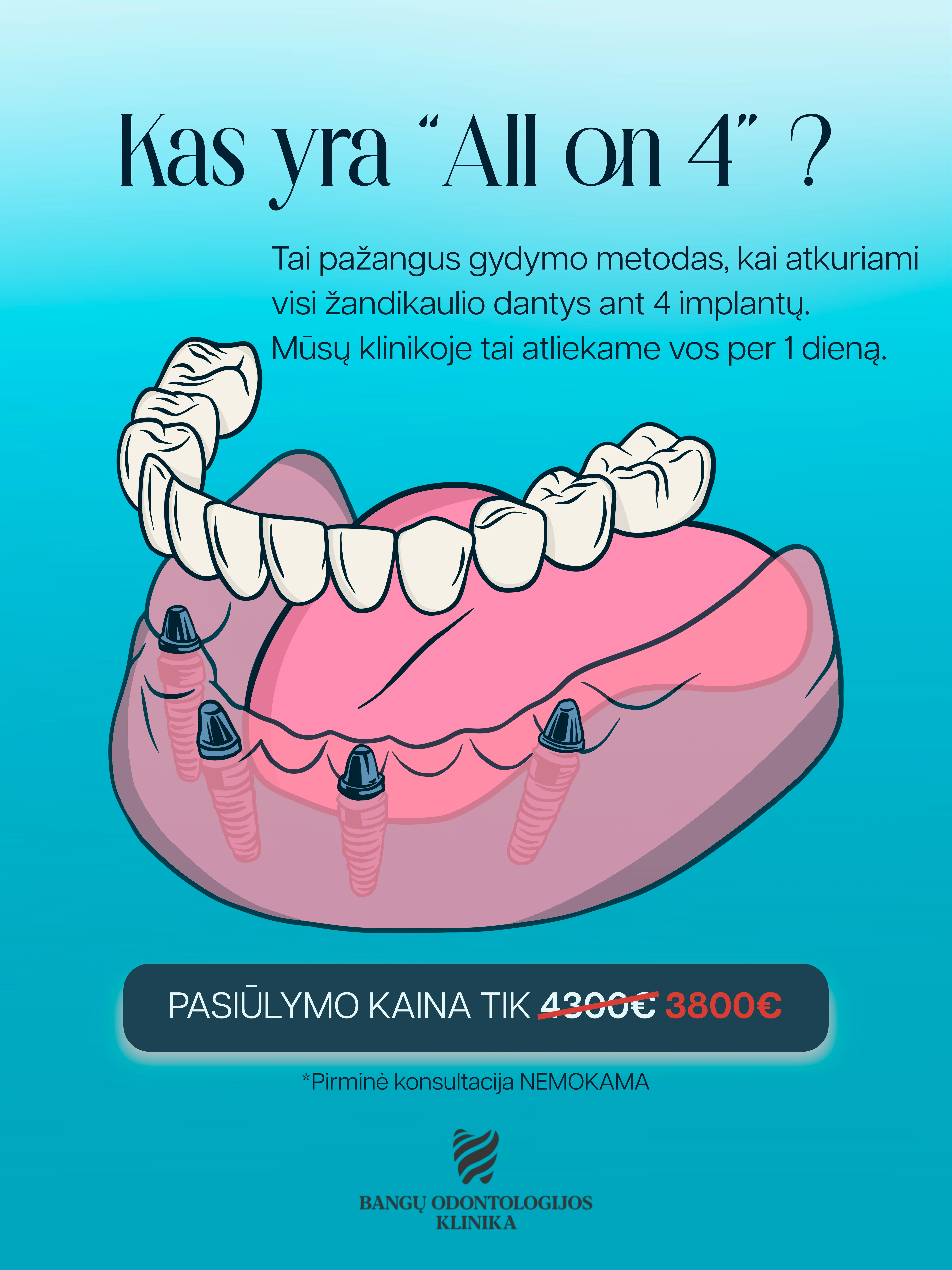ALL-ON-4 implantacija